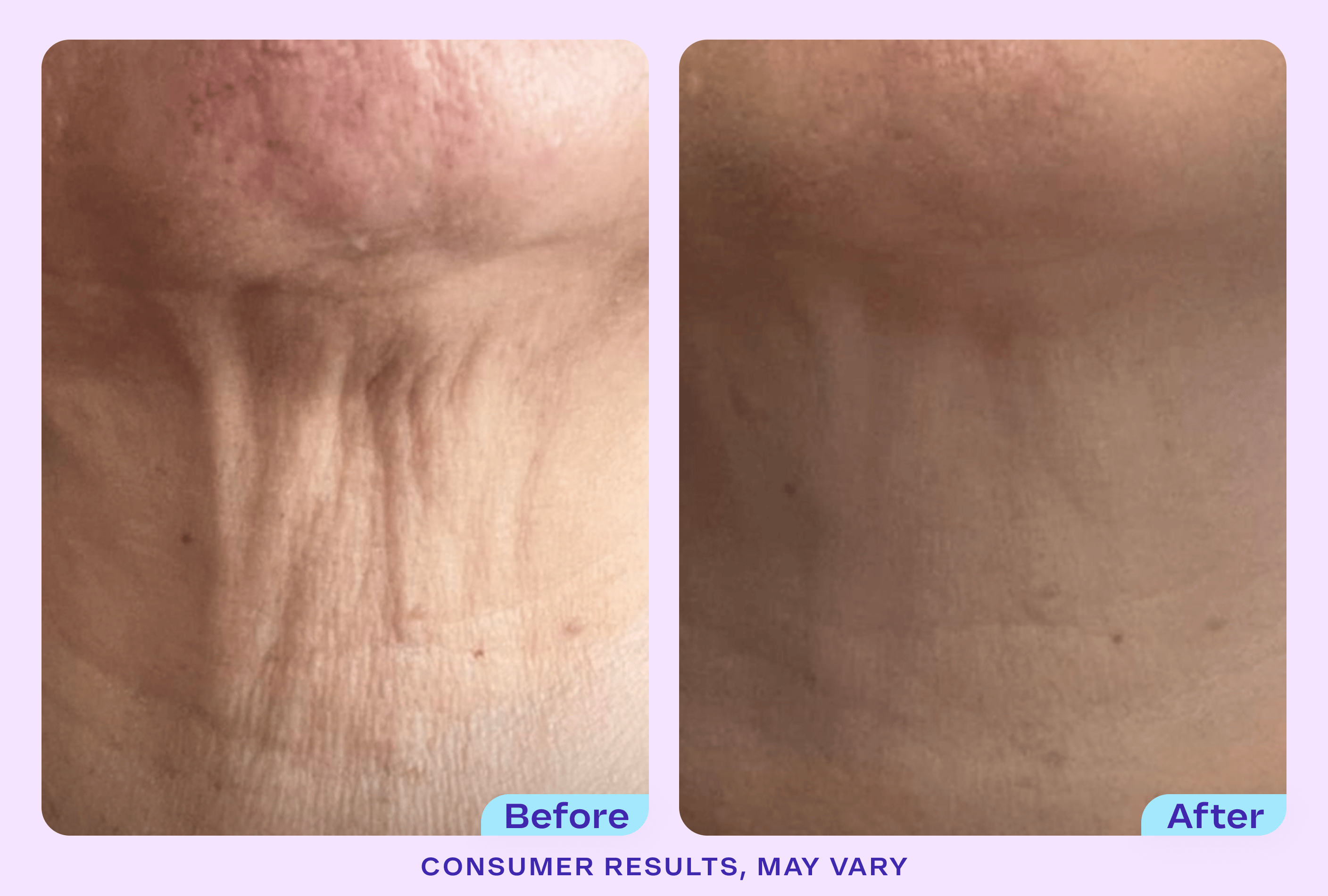 Tighten & Lift Neck Cream - NC41